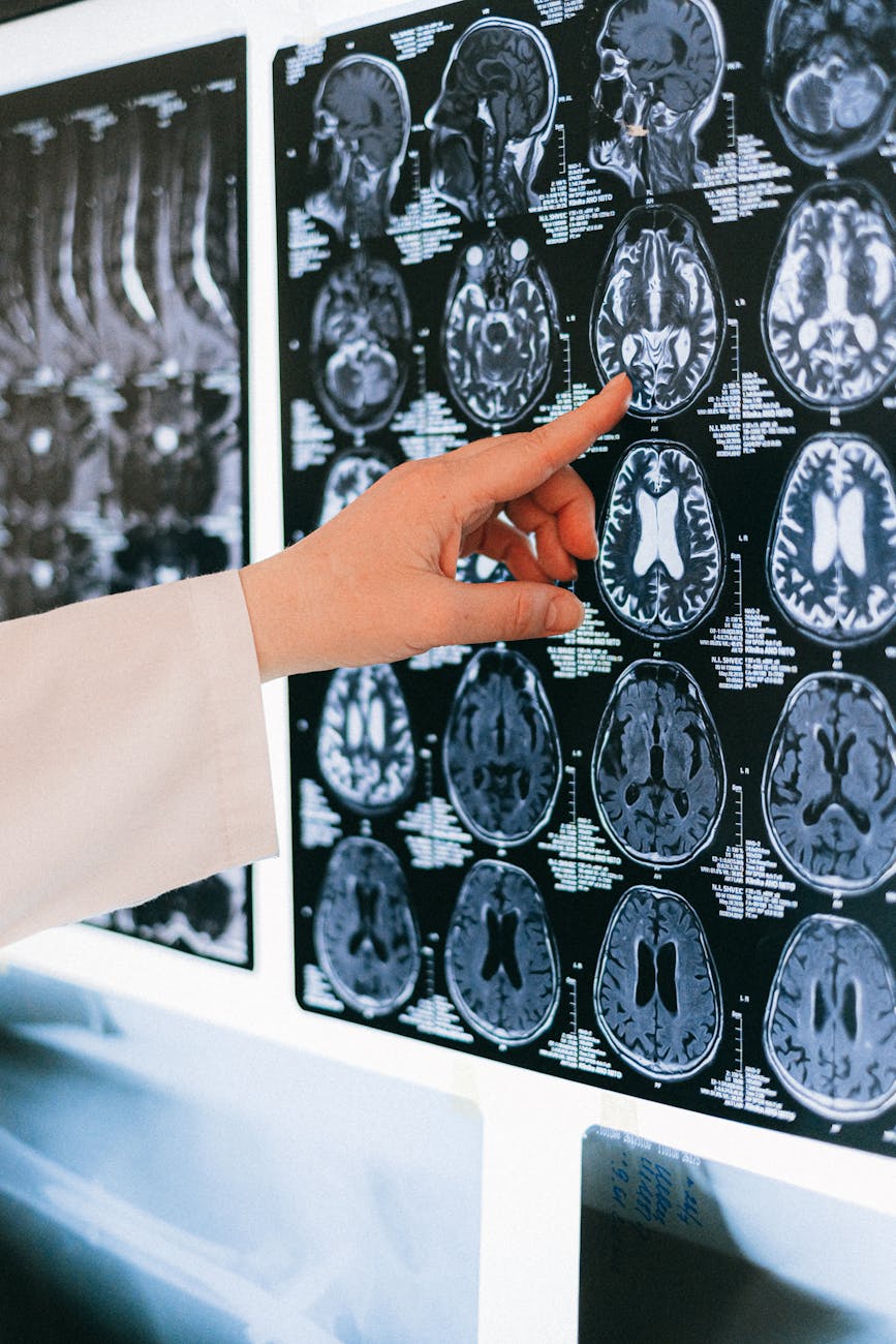 Parkinson’s Disease Books