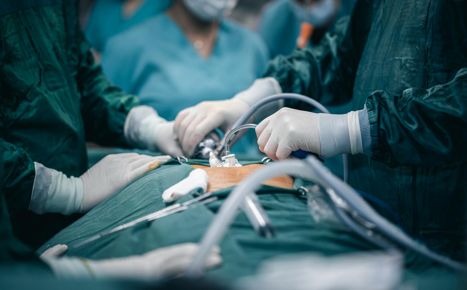 Laparoscopic and Robotic Surgery Books